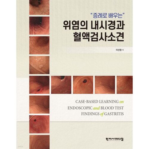 Résultats endoscopiques et sanguins pour la gastrite 